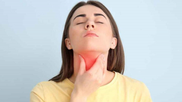 কীভাবে বুঝবেন আপনি থাইরয়েড রোগী?