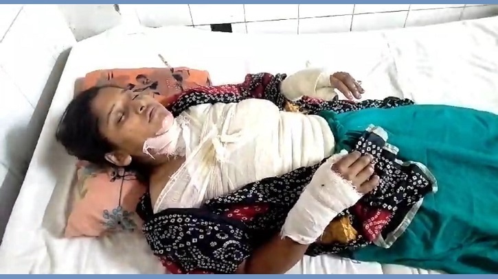 যৌতুকের দাবিতে গৃহবধূকে পুড়িয়ে হত্যার চেষ্টা, গ্রেফতার ৪ যৌতুকের দাবিতে গৃহবধূকে পুড়িয়ে হত্যার চেষ্টা, গ্রেফতার ৪